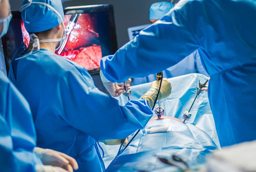 Laparoscopic Surgery